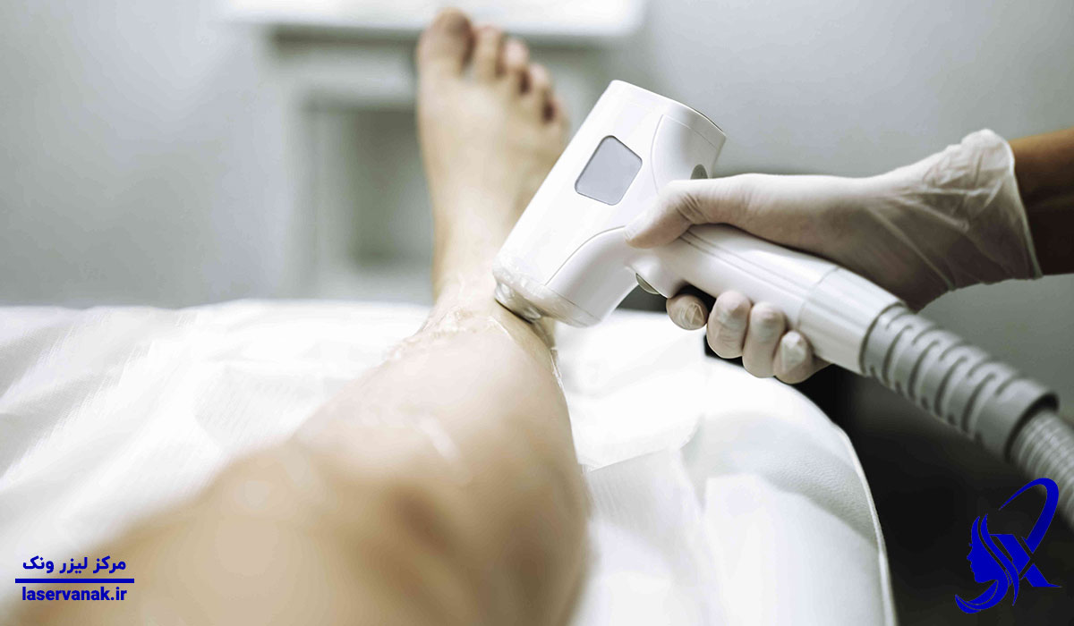 بهترین مرکز لیزر موهای زائد در ونک