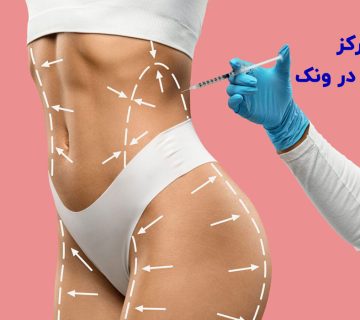 بهترین مرکز فیلر بادی در ونک