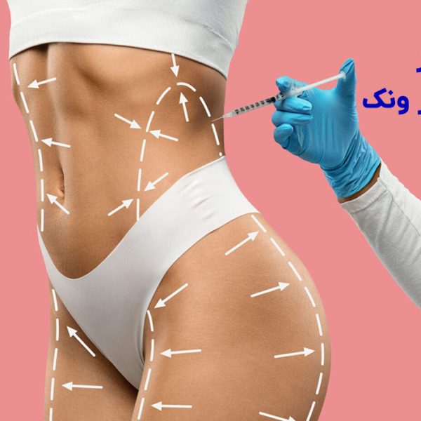 بهترین مرکز فیلر بادی در ونک