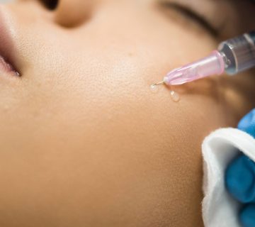 بهترین مرکز کربوکسی تراپی در ونک