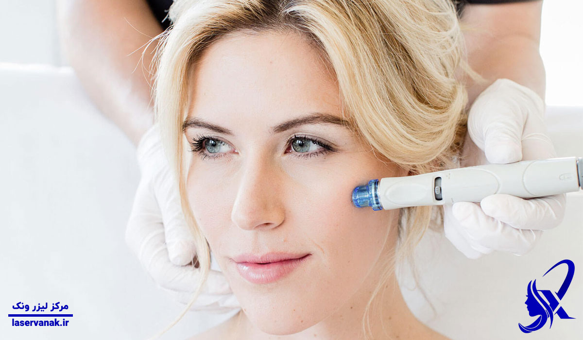 بهترین مرکز کربوکسی تراپی در ونک