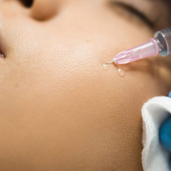 بهترین مرکز کربوکسی تراپی در ونک