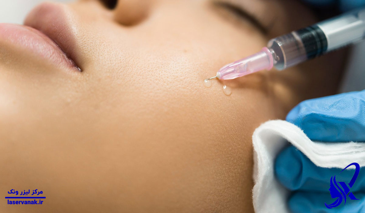 بهترین مرکز کربوکسی تراپی در ونک