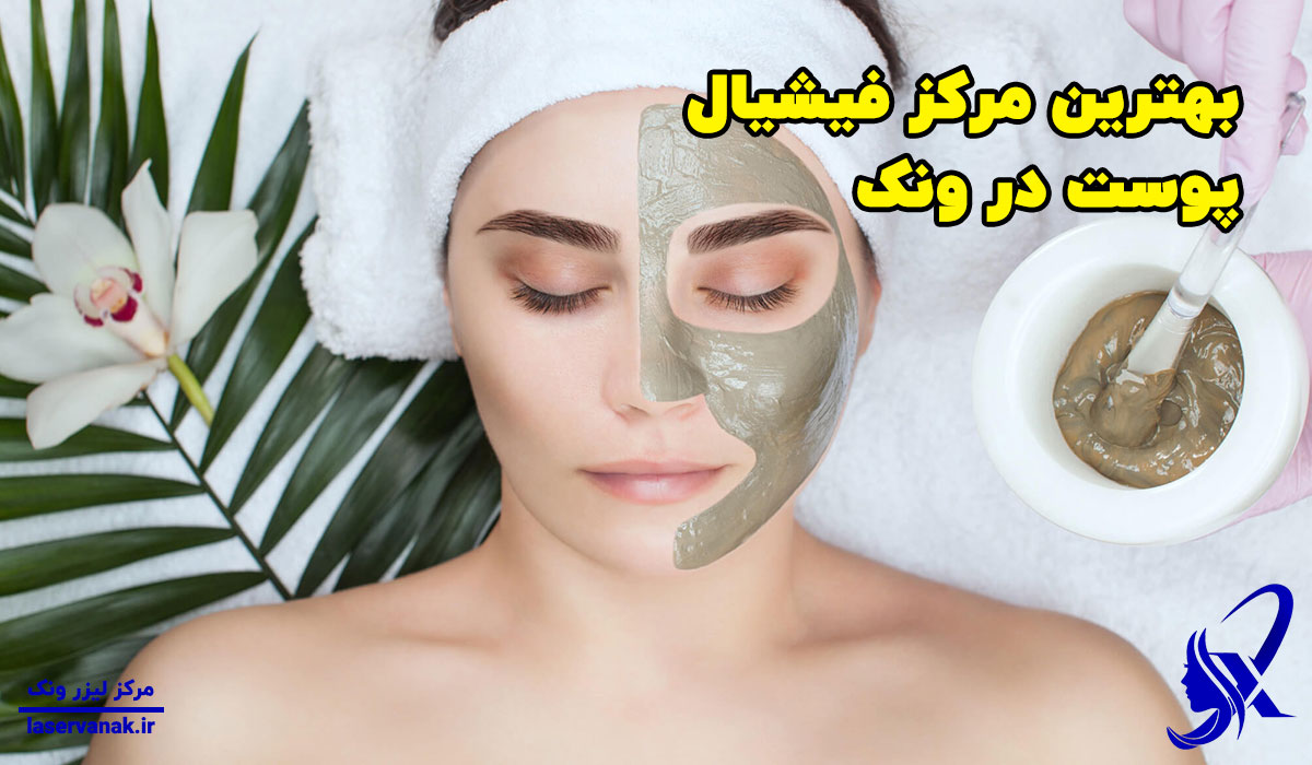 بهترین مرکز فیشیال پوست در ونک