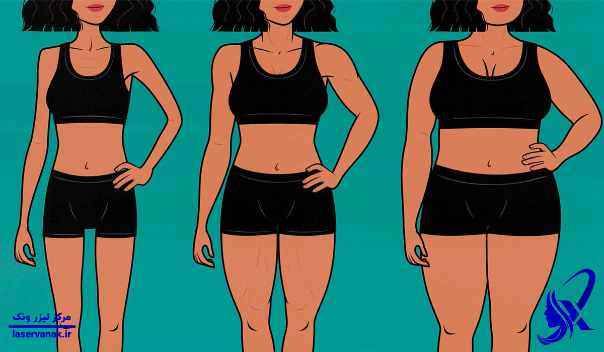 بهترین مرکز لاغری با امبدینگ (کاشت نخ) در ونک